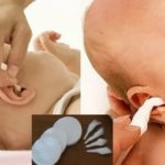 Как делать компресс новорожденному на животе