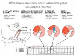 Могут ли быть выделения во время лактации