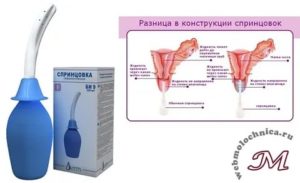 Чем спринцеваться при бесплодии