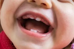 Как прорезываются зубы у грудничков последовательность и симптомы
