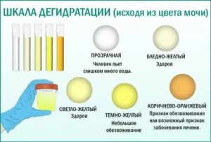 Когда у новорожденного моча становиться желтой