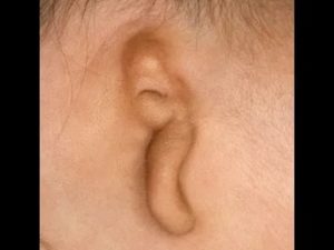 Можно ли сломать ухо новорожденному