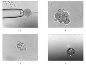 Что такое культивирование гамет и эмбрионов