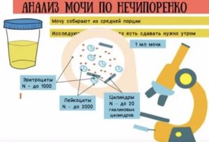 Как собрать мочу у новорожденного по нечипоренко