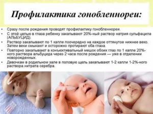 Как проводится профилактика гонобленнореи новорожденного