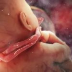 Почему потемнела кожа в интимных местах после родов