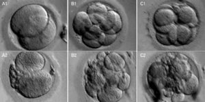 Как приживаются эмбрионы удовлетворительного качества