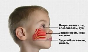 Что делать если у грудного ребенка заложен нос и кашель