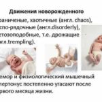 Что такое запрокидывание головки у новорожденных