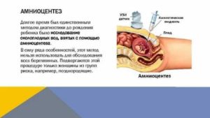 Что такое анализ на околоплодные воды и как он делается