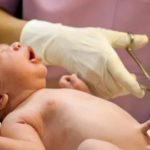 Почему у новорожденного длинные пальцы