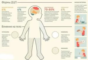 Можно ли беременеть при дцп