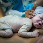Что такое смещение шейных позвонков у новорожденных