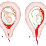 Как правильно подготовиться к криопереносу эмбрионов