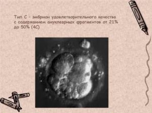 Как приживаются эмбрионы удовлетворительного качества