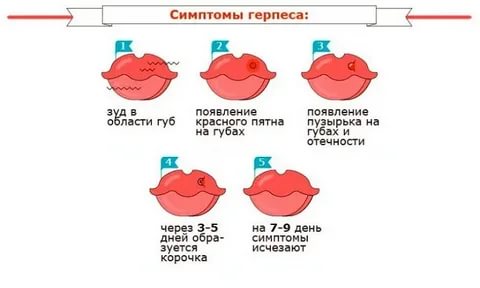 Через сколько после герпеса на губе можно планировать беременность