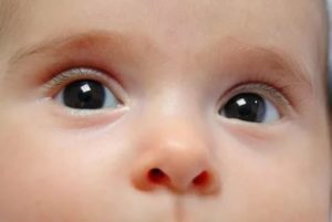Почему у новорожденного глазное яблоко желтое