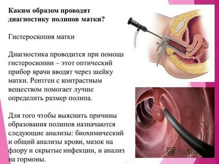 Через сколько после удаления полипа можно планировать беременность после