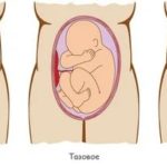 Как правильно пить шалфей в пакетиках для зачатия