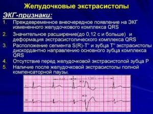 Что такое экстрасистолы у новорожденных