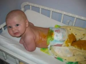 Почему новорожденный ребенок часто какает