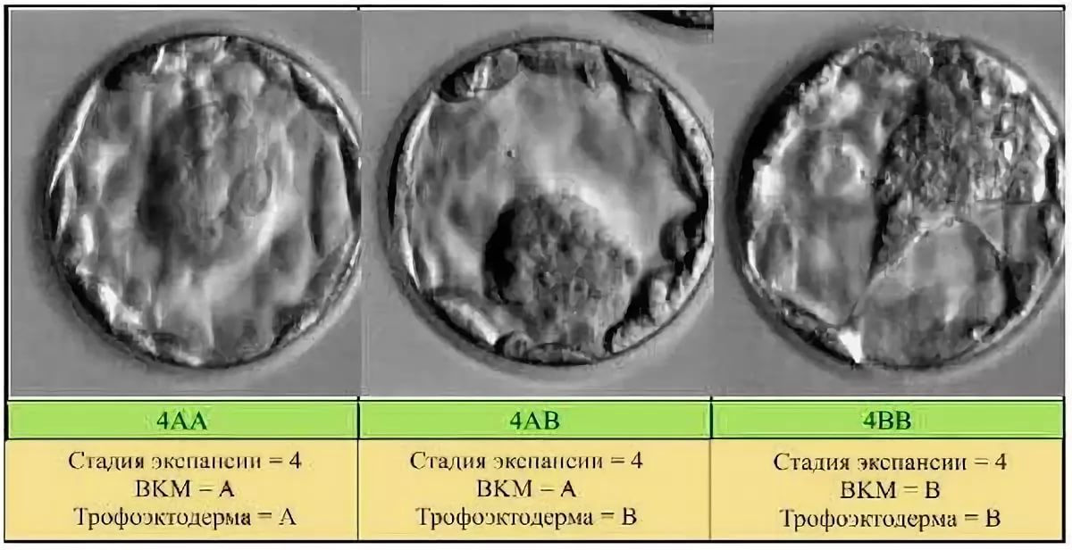 5 дневка эмбрион. Бластоциста 4аа. Эмбрионы 3вв и 4вв. Бластоциста эмбрион 5 АА. Классификация эмбриона 4аа.