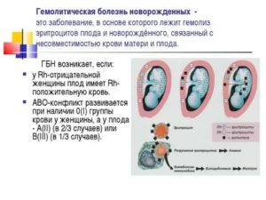 Что такое несовместимость крови у новорожденного