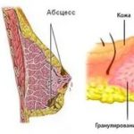 Что такое 1-я репродукция в сортах картофеля