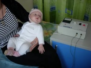 Как правильно делать электрофорез с эуфиллином новорожденному
