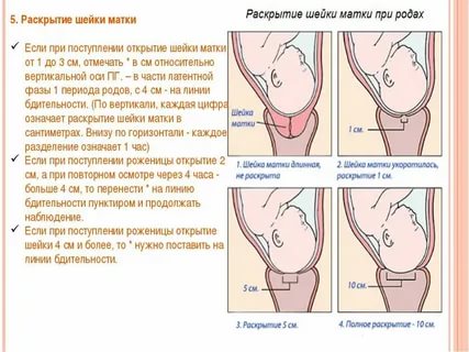 Сколько нужно времени для подготовки шейки матки к родам