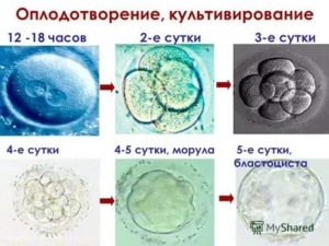 Что такое культивирование гамет и эмбрионов