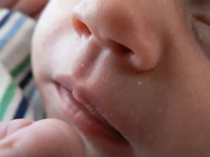 Почему у грудного ребенка синеет верхняя губа