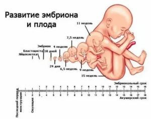 Как быть если один плод развивается а второй замер