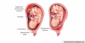 Как плацента защищает ребенка от болезни матери