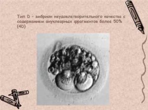 Как приживаются эмбрионы удовлетворительного качества