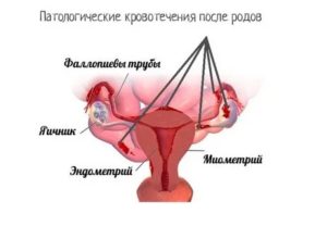 Сколько после родов идет кровотечение у женщины