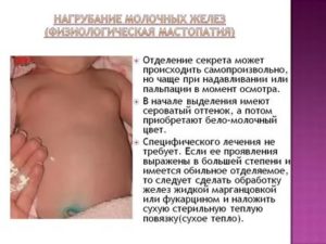 Что делать если у новорожденного уплотнение в молочной железе