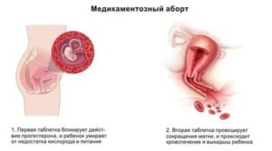 Можно ли забеременеть после таблеток для выкидыша