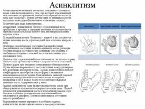 Что такое асинклитическое вставление головки плода