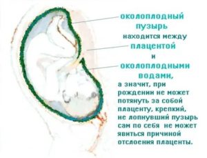 Почему лопается плодный пузырь на ранних сроках