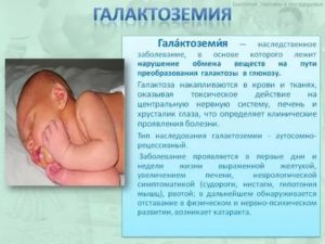 Что такое генетическое заболевание у новорожденного ребенка