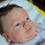 Что такое нарушение мозгового кровообращения у новорожденного и его последствия