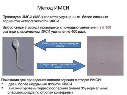 Эко икси имси что это такое