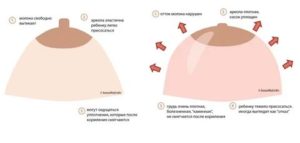 Почему набухшие грудные железы после месячных