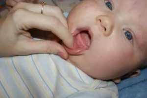 Почему у новорожденного слюни густые