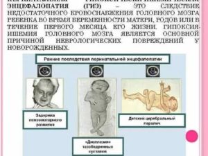 Что такое гипоксические изменения головного мозга у новорожденного