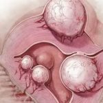 Как улучшить качество спермограммы для зачатия народными средствами