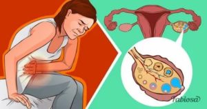 Почему женщина не беременеет во время овуляции