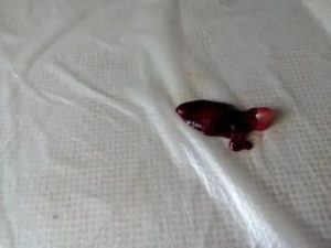 Кровь при зачатии или это выкидыш