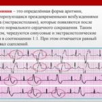 Как обновляются околоплодные воды куда они деваются